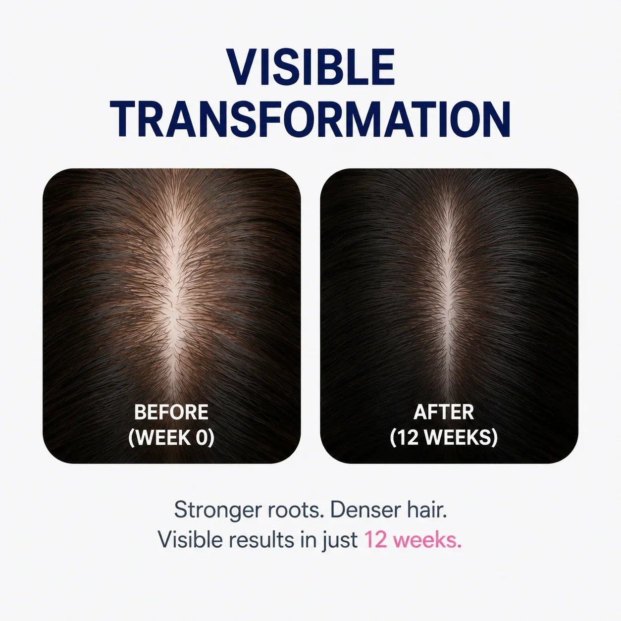 Exome_Hair_Growth_Spray3.jpg